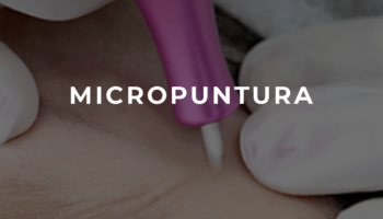 MICROPUNTURA