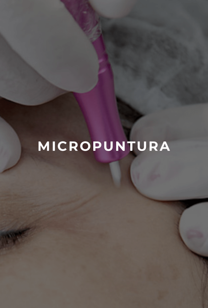 MICROPUNTURA