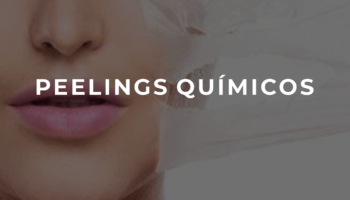 PEELINGS QUIMICOS